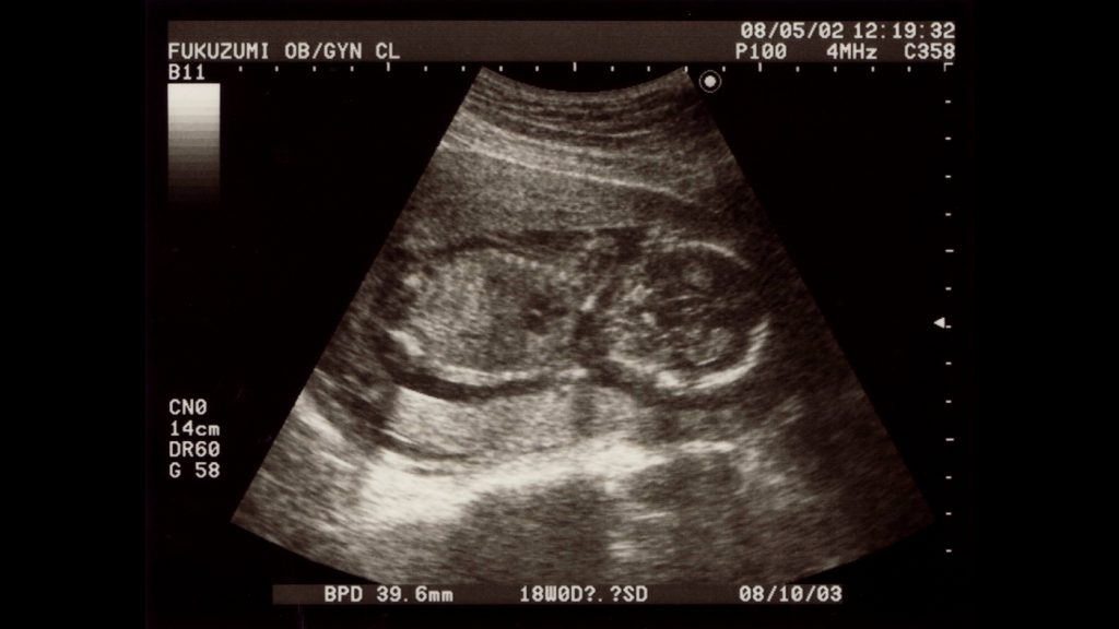 « Qui parle? / Moi, dedans » : haptonomie et dialogues avec le fœtus dans Bouli année zéro