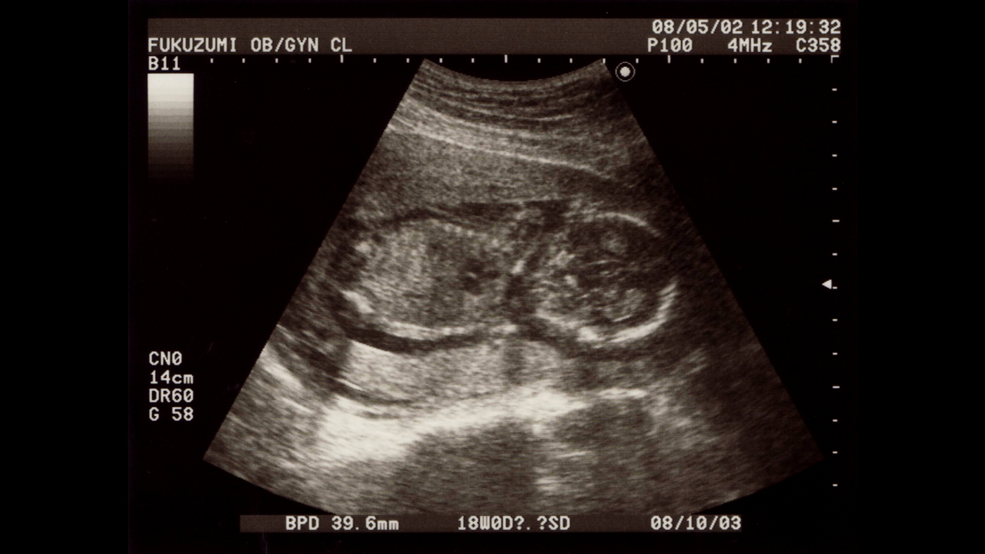 Carre-Drean_Couv_web